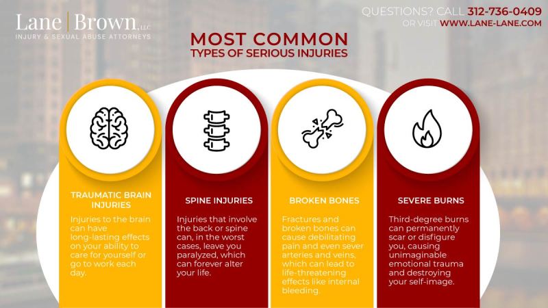 Personal Injury Lawyer Naperville Il